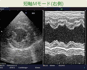 短軸Mモード(右側)