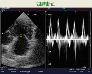 四腔断面